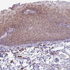 Immunohistochemical staining of human skin shows moderate cytoplasmic positivity in squamous epithelial cells.