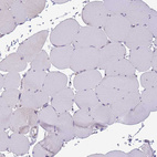 Immunohistochemical staining of human skeletal muscle shows no positivity in myocytes as expected.