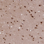 Anti-SRSF2 Antibody