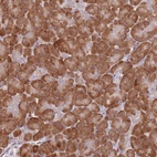 Anti-CCNJL Antibody