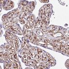 Anti-SERPINE1 Antibody