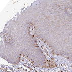 Anti-SERPINE1 Antibody