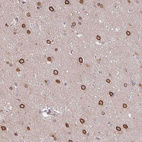 Anti-RANGAP1 Antibody