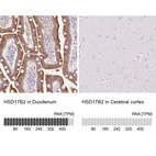 Anti-HSD17B2 Antibody