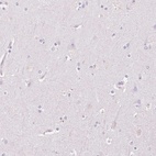 Anti-HSD17B2 Antibody