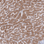 Anti-TMED5 Antibody