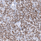 Anti-TMED5 Antibody