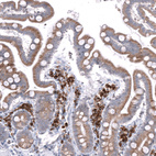 Anti-TMED5 Antibody