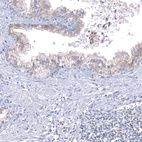 Anti-TMED5 Antibody