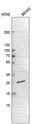 Anti-TMED5 Antibody