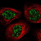 Anti-C11orf84 Antibody