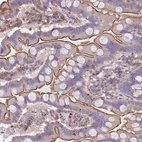 Anti-LRRN4CL Antibody