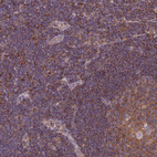 Anti-LRRN4CL Antibody