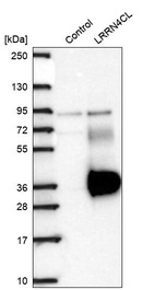 Anti-LRRN4CL Antibody