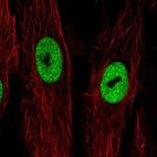 Anti-LRRN4CL Antibody