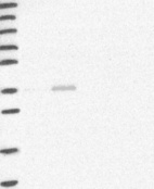 Anti-HAO2 Antibody