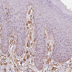 Anti-RCN3 Antibody