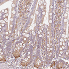 Anti-RCN3 Antibody