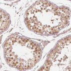 Anti-RCN3 Antibody