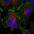 Anti-TP53BP2 Antibody