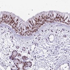 Anti-TBC1D26 Antibody