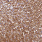 Anti-STEAP3 Antibody