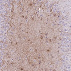 Anti-ZNF311 Antibody