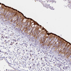 Anti-DNAI2 Antibody