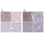 Anti-SFRP4 Antibody