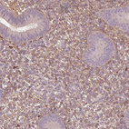 Anti-SFRP4 Antibody