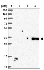 Anti-SFRP4 Antibody