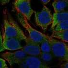 Anti-GGPS1 Antibody