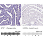 Anti-SPEF1 Antibody