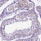 Anti-SPEF1 Antibody