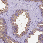 Anti-SPEF1 Antibody