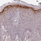 Anti-ISLR Antibody