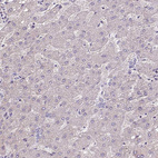 Anti-ISLR Antibody