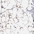 Anti-TUSC5 Antibody