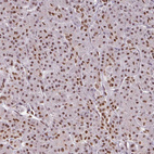 Anti-IRF2BPL Antibody