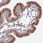 Anti-IRF2BPL Antibody