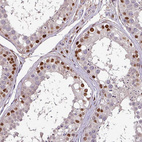 Anti-IRF2BPL Antibody