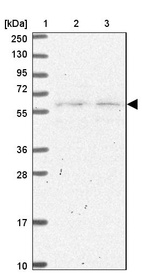 Anti-SLC25A23 Antibody