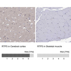 Anti-RTP5 Antibody