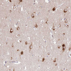 Anti-ATP13A2 Antibody