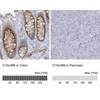 Anti-C10orf99 Antibody