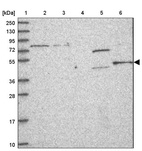 Anti-ZC2HC1C Antibody