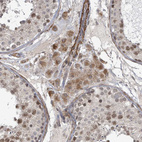 Anti-SBF2 Antibody