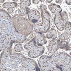 Anti-SBF2 Antibody