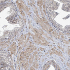 Anti-SBF2 Antibody