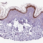 Anti-SLURP1 Antibody